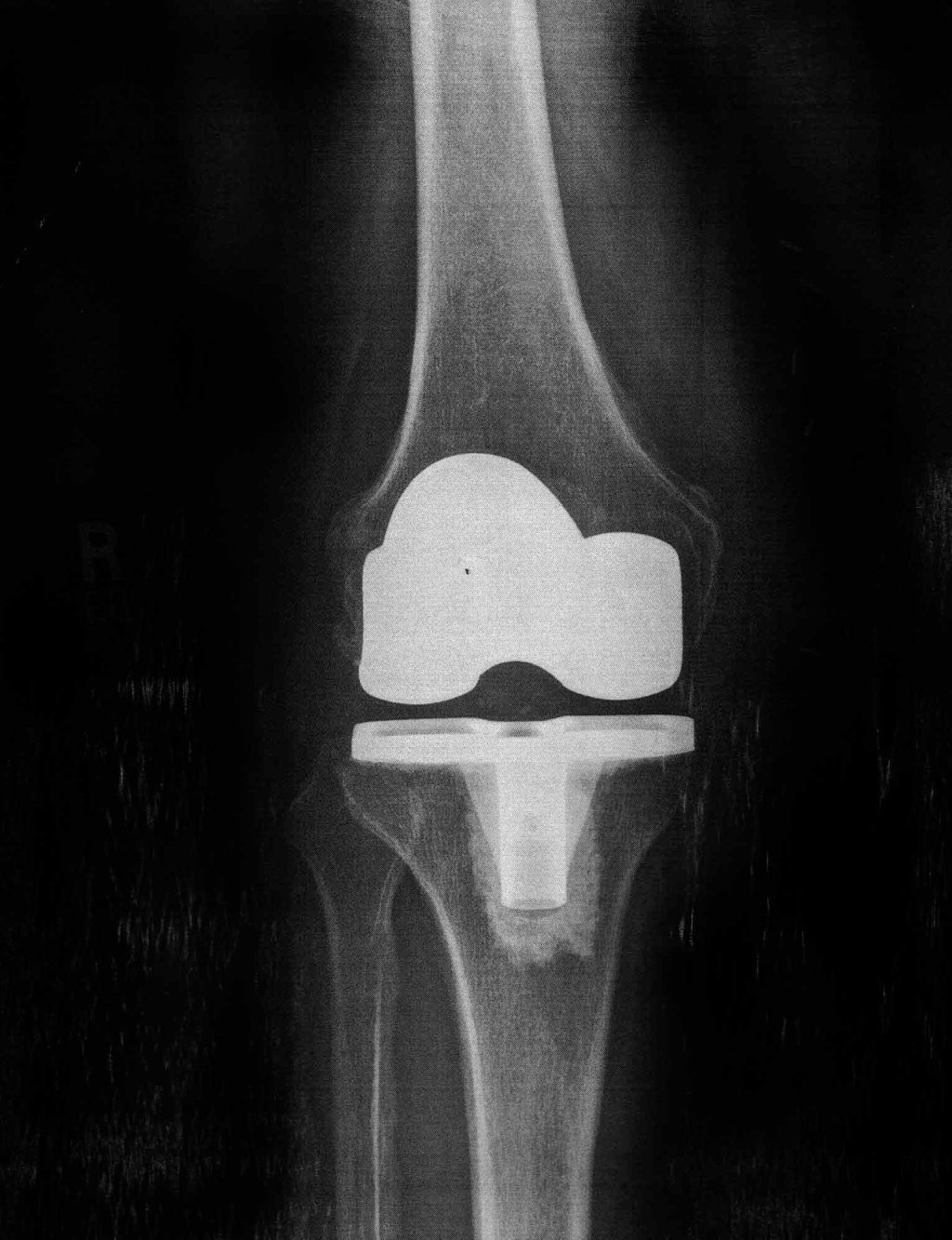 kneexray.jpg